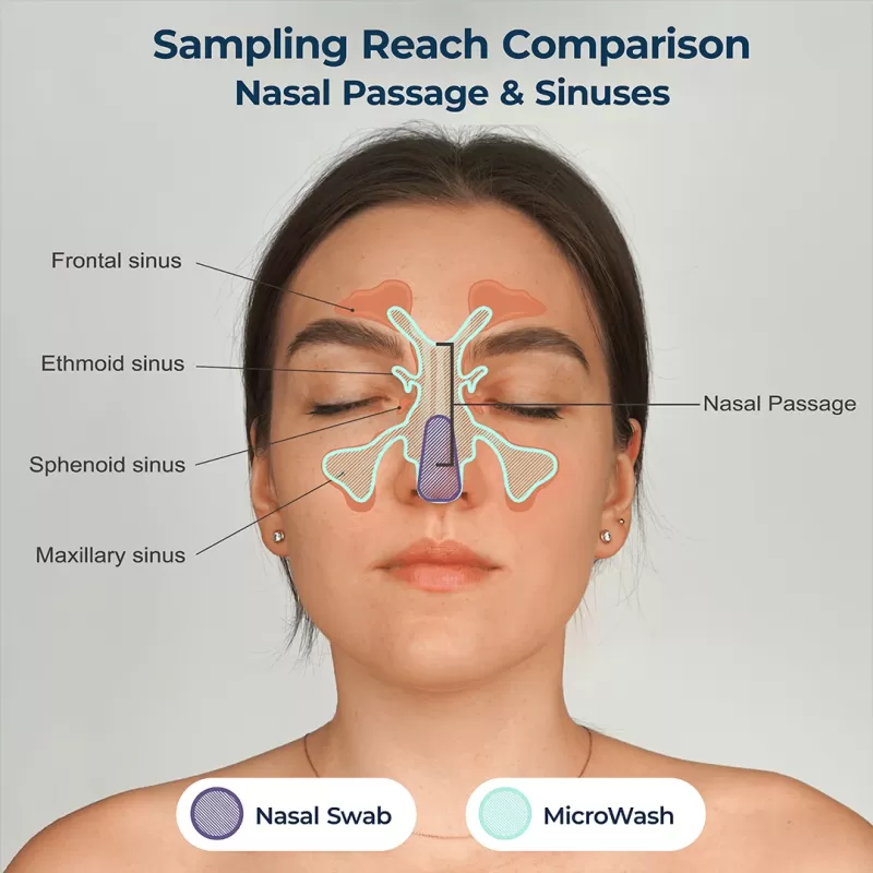 0825 nasal sample sensitivity min 0825 nasal sample sensitivity min